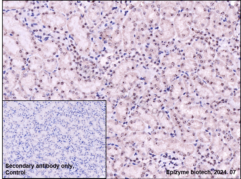 Anti-Phospho-ATM (Ser1981) Rabbit mAb [79T70I07]
