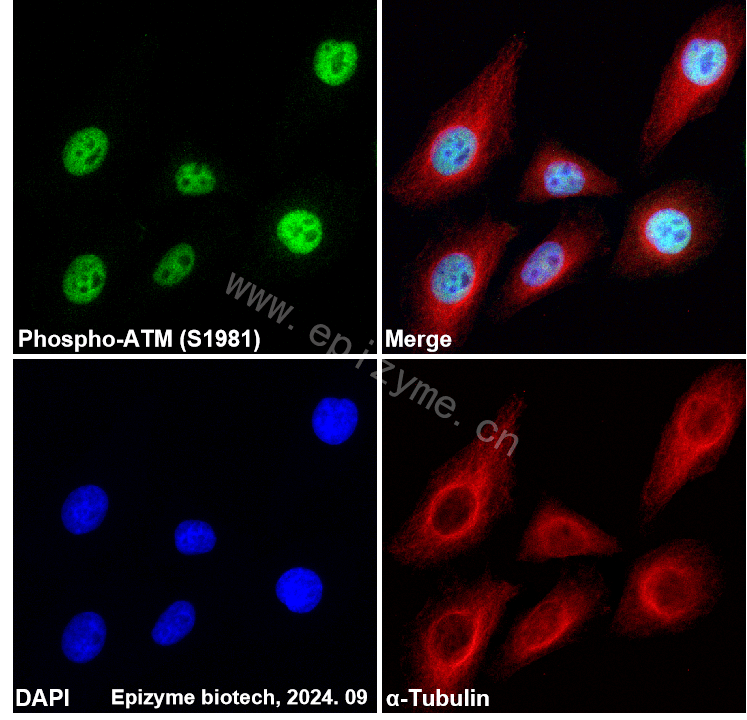 Anti-Phospho-ATM (Ser1981) Rabbit mAb [79T70I07]