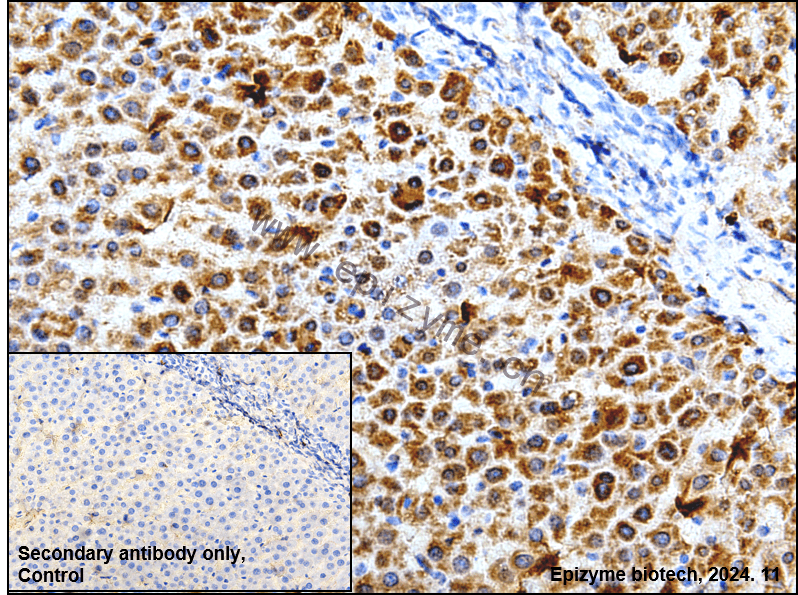 Anti-alpha 2 Macroglobulin Rabbit mAb [95P27C35]