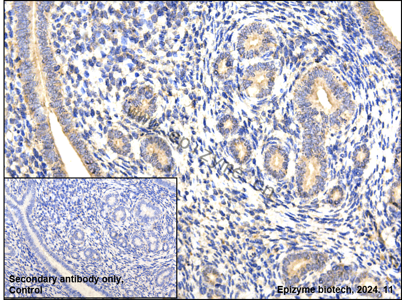 Anti-alpha 2 Macroglobulin Rabbit mAb [95P27C35]