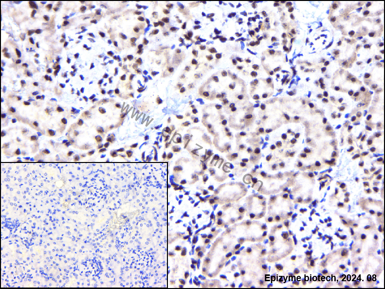 Anti-BAF57 Rabbit mAb [33K67P30]