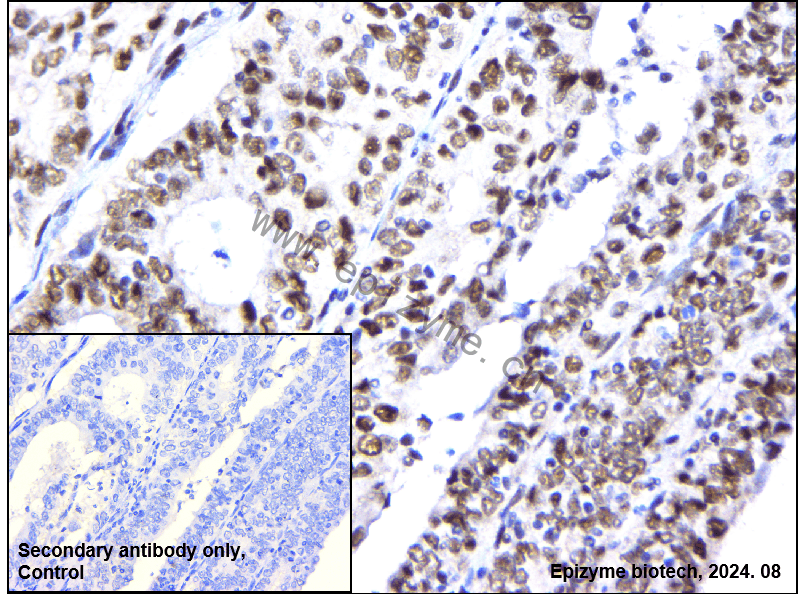 Anti-BAF57 Rabbit mAb [33K67P30]