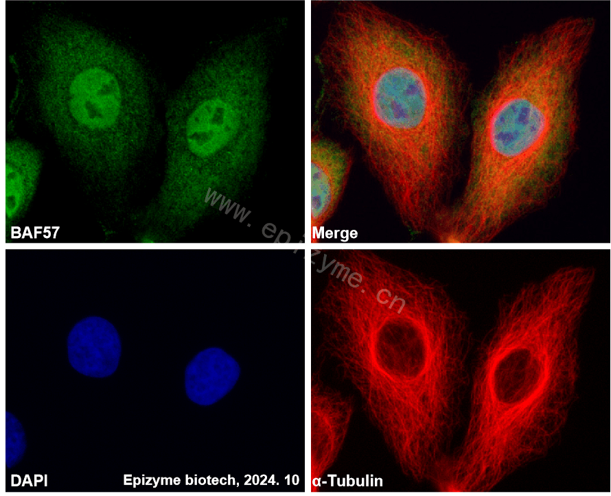 Anti-BAF57 Rabbit mAb [33K67P30]