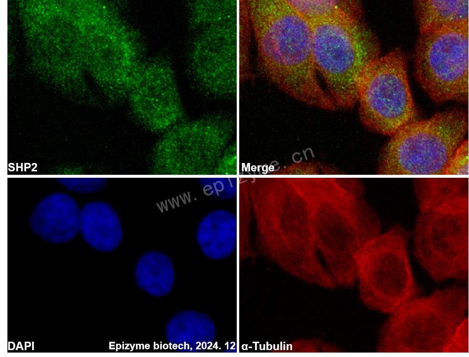 Anti-SHP2 Rabbit mAb [69E66O87]