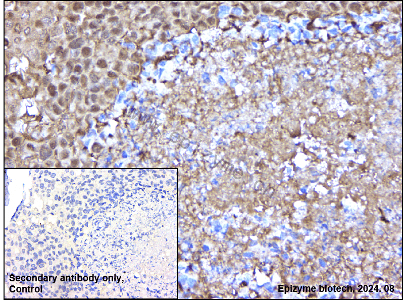 Anti-14-3-3 alpha/beta Rabbit mAb [70P10Q35]