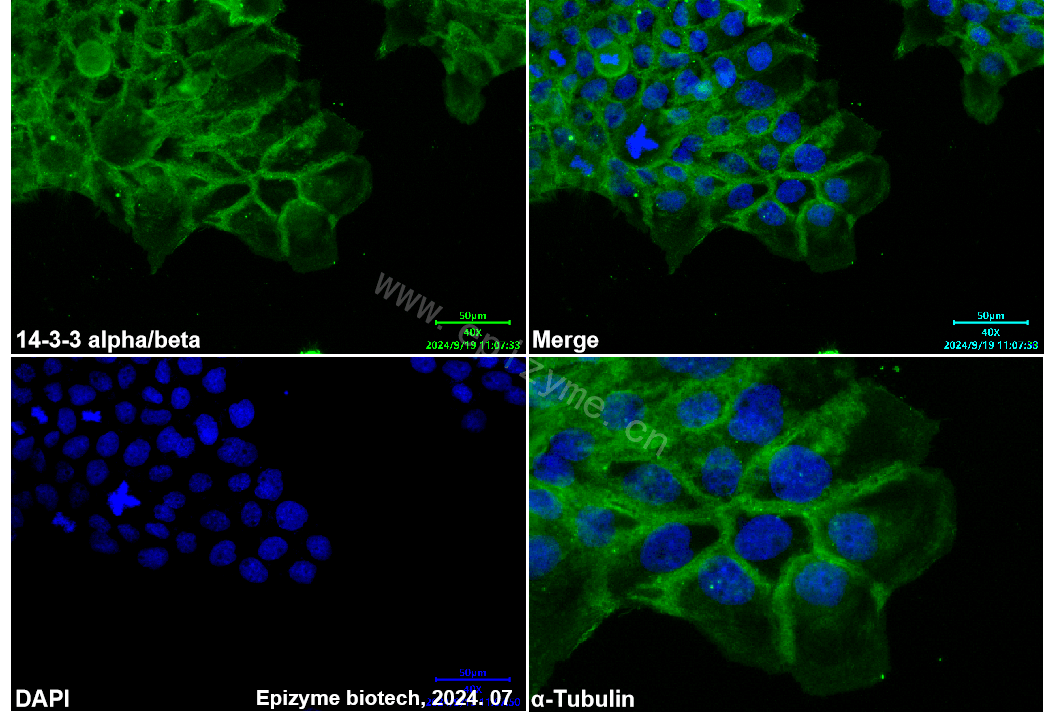 Anti-14-3-3 alpha/beta Rabbit mAb [70P10Q35]
