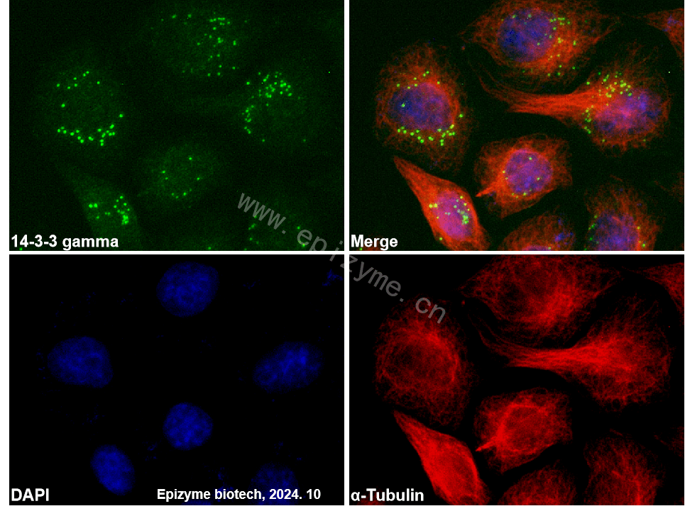 Anti-14-3-3 gamma Rabbit mAb [36R86K80]