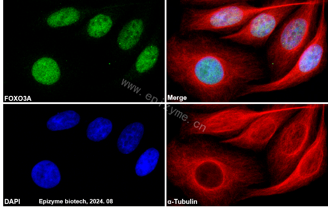 Anti-FOXO3A Rabbit mAb [76K53R97]