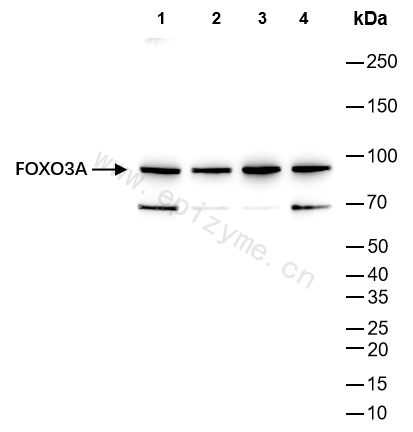 Anti-FOXO3A Rabbit mAb [76K53R97]