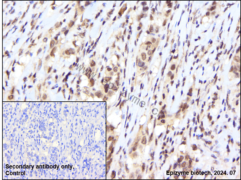 Anti-FOXO3A Rabbit mAb [76K53R97]