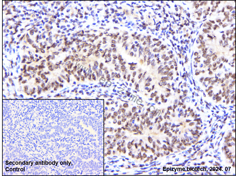 Anti-FOXO3A Rabbit mAb [76K53R97]