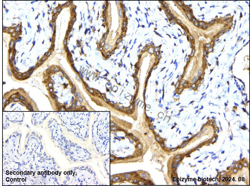 Anti-PRMT5 Rabbit mAb [12E45R27]