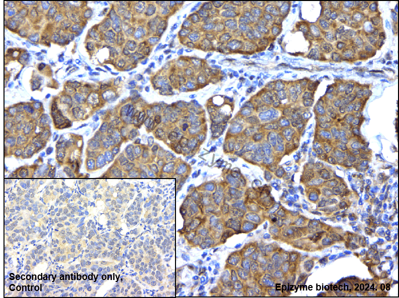 Anti-PRMT5 Rabbit mAb [12E45R27]