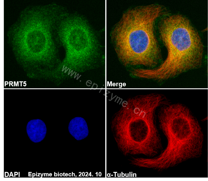 Anti-PRMT5 Rabbit mAb [12E45R27]