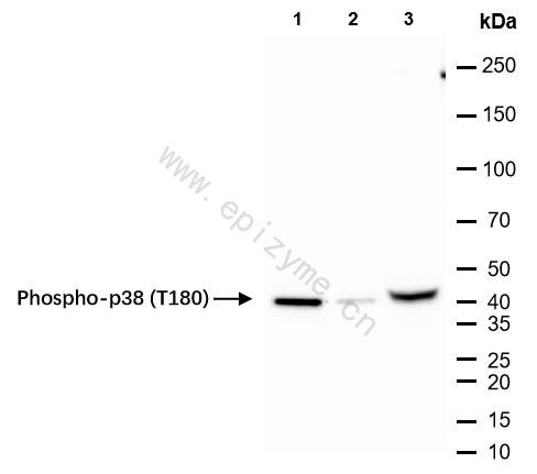 Anti-Phospho-p38 (Thr180) Rabbit mAb [69S82G28]
