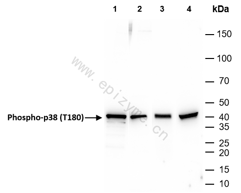 Anti-Phospho-p38 (Thr180) Rabbit mAb [69S82G28]