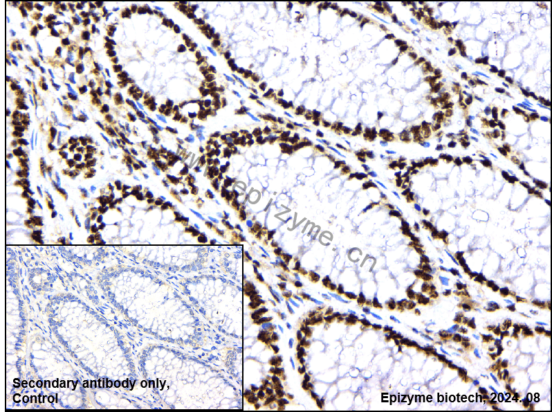 Anti-Phospho-p38 (Thr180) Rabbit mAb [69S82G28]