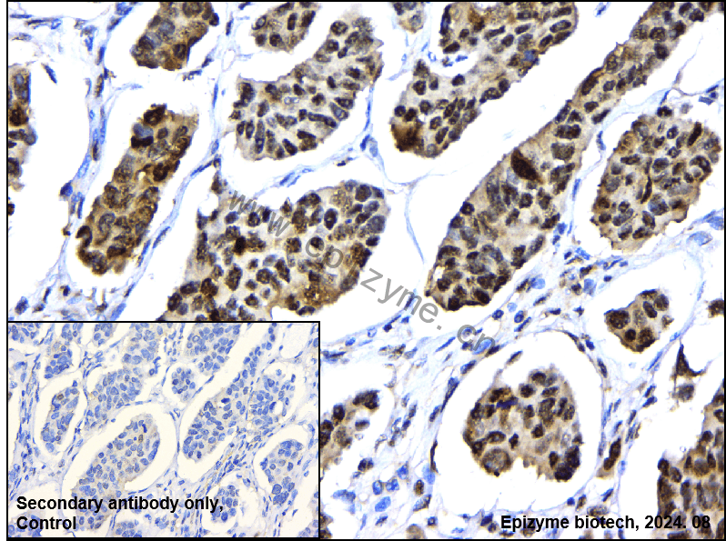 Anti-Phospho-p38 (Thr180) Rabbit mAb [69S82G28]