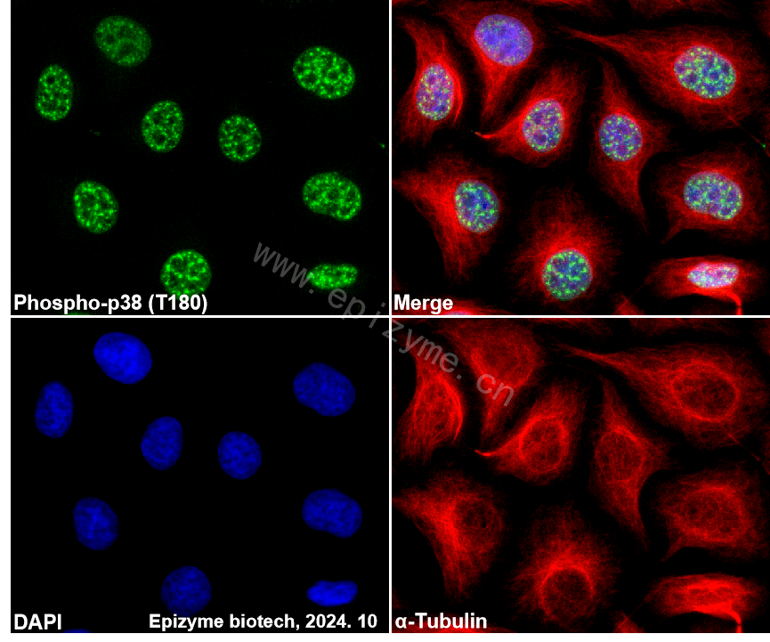 Anti-Phospho-p38 (Thr180) Rabbit mAb [69S82G28]
