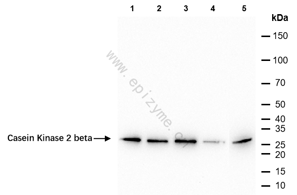Anti-Casein Kinase 2 beta Rabbit mAb [15A24F83]