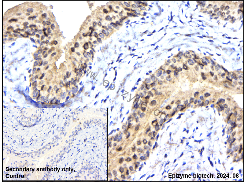 Anti-Casein Kinase 2 beta Rabbit mAb [15A24F83]