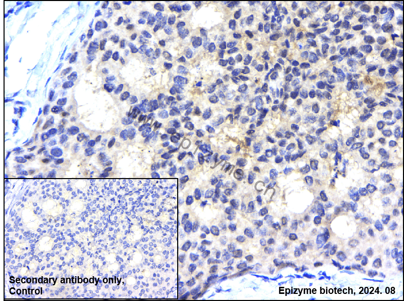 Anti-Casein Kinase 2 beta Rabbit mAb [15A24F83]