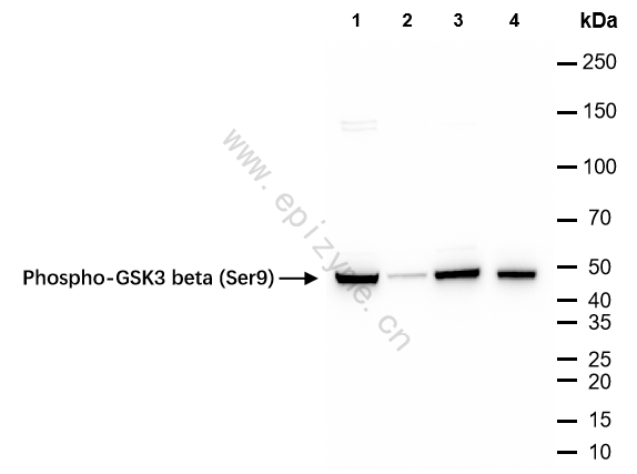 Anti-Phospho-GSK3 beta (Ser9) Rabbit mAb [51C27D91]