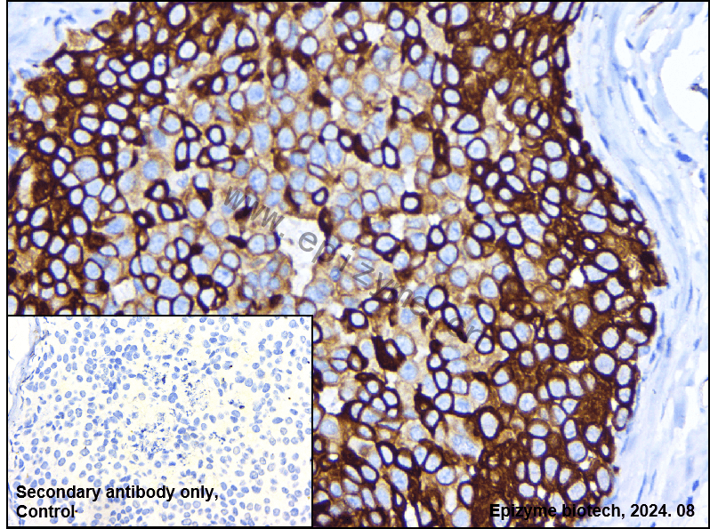 Anti-Phospho-GSK3 beta (Ser9) Rabbit mAb [51C27D91]