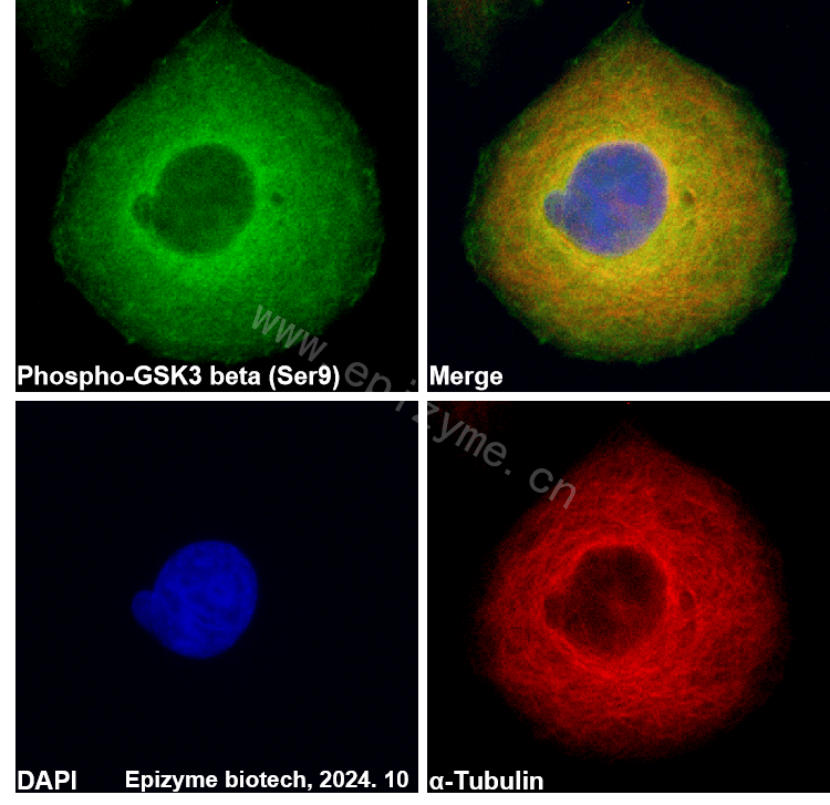 Anti-Phospho-GSK3 beta (Ser9) Rabbit mAb [51C27D91]