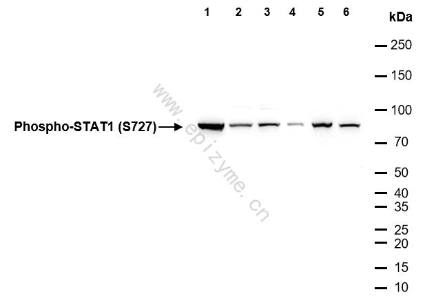 Anti-Phospho-STAT1 (Ser727) Rabbit mAb [49R97B18]