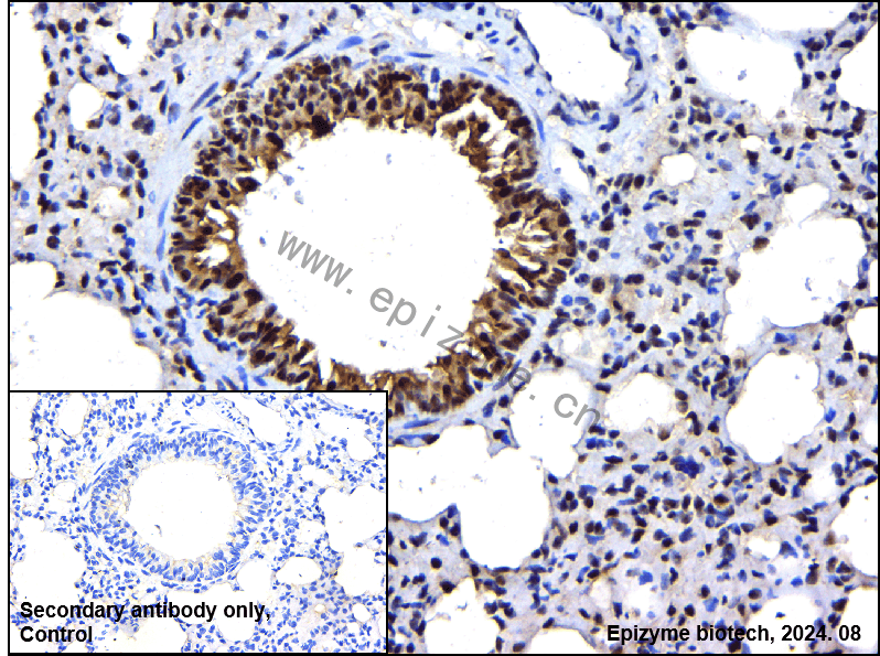 Anti-Phospho-STAT1 (Ser727) Rabbit mAb [49R97B18]