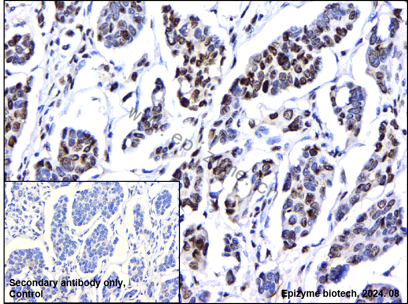 Anti-Phospho-STAT1 (Ser727) Rabbit mAb [49R97B18]