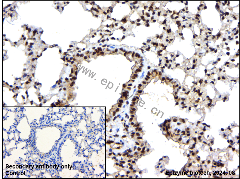 Anti-Phospho-STAT1 (Ser727) Rabbit mAb [49R97B18]