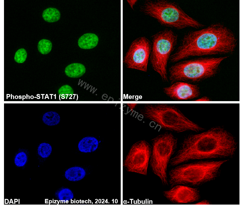 Anti-Phospho-STAT1 (Ser727) Rabbit mAb [49R97B18]
