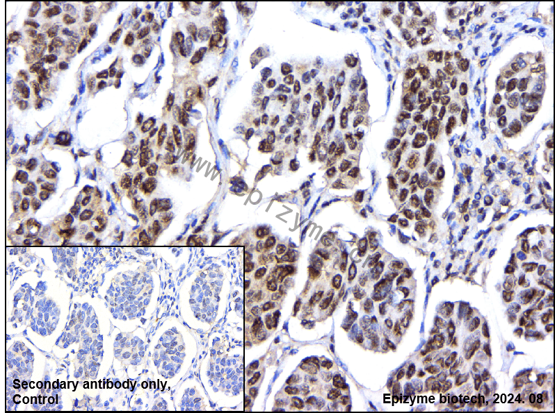Anti-Brd4 Rabbit mAb [33R30C33]