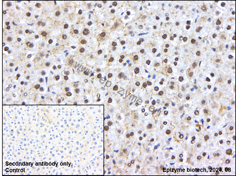 Anti-Brd4 Rabbit mAb [33R30C33]