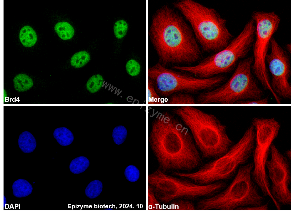 Anti-Brd4 Rabbit mAb [33R30C33]