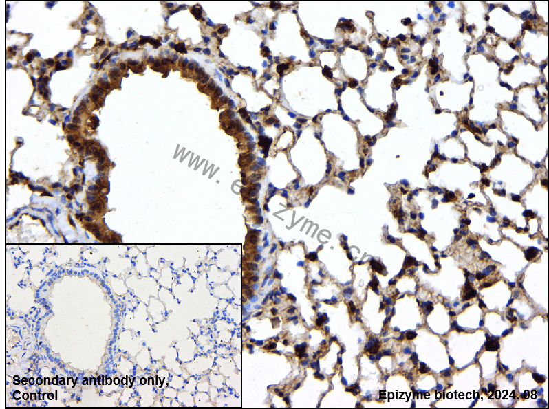 Anti-STAT5a Rabbit mAb [17B09T59]