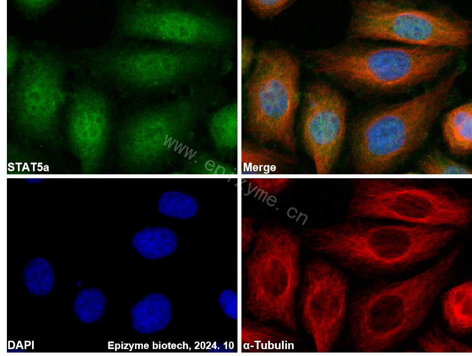 Anti-STAT5a Rabbit mAb [17B09T59]
