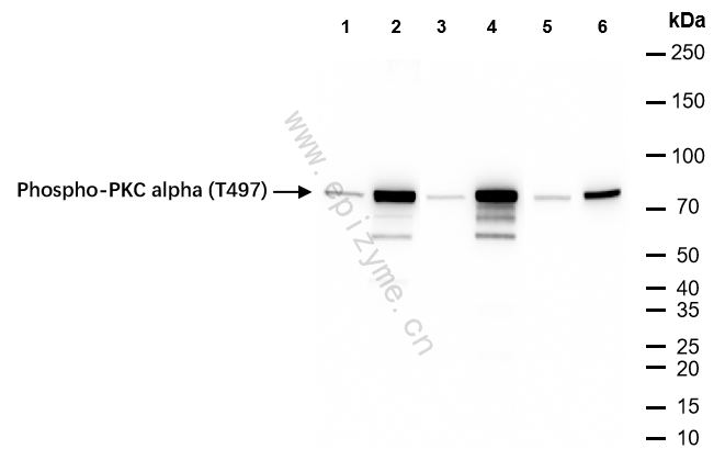 Anti-Phospho-PKC alpha (Thr497) Rabbit mAb [28S72F95]
