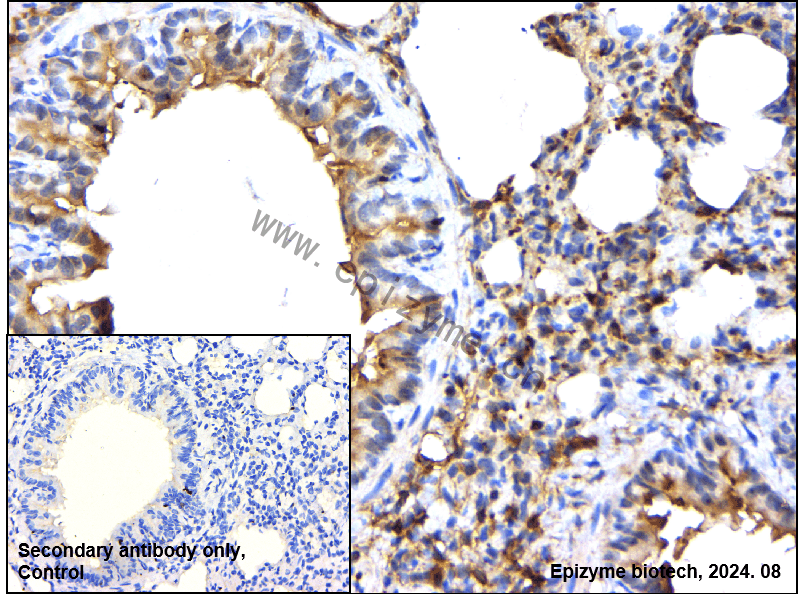 Anti-Phospho-PKC alpha (Thr497) Rabbit mAb [28S72F95]