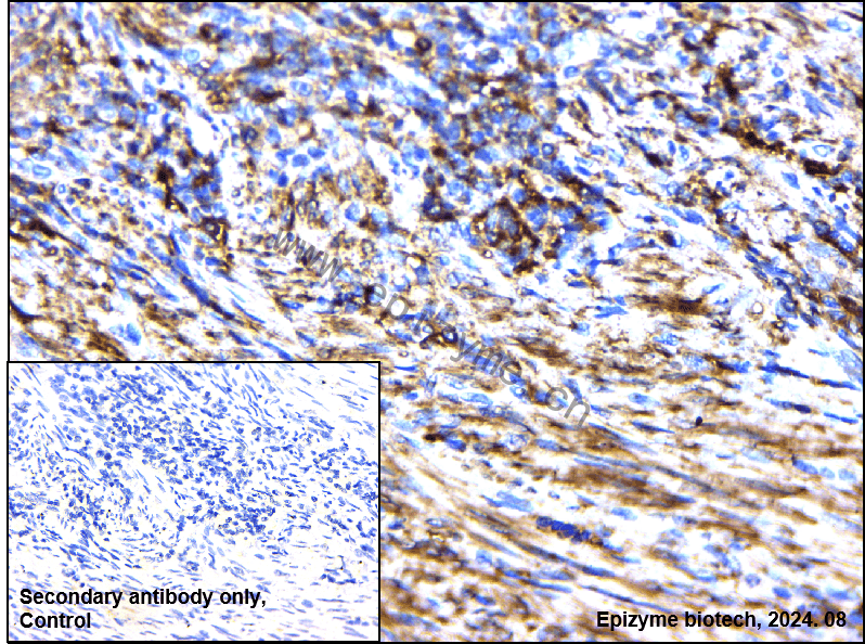 Anti-Phospho-PKC alpha (Thr497) Rabbit mAb [28S72F95]
