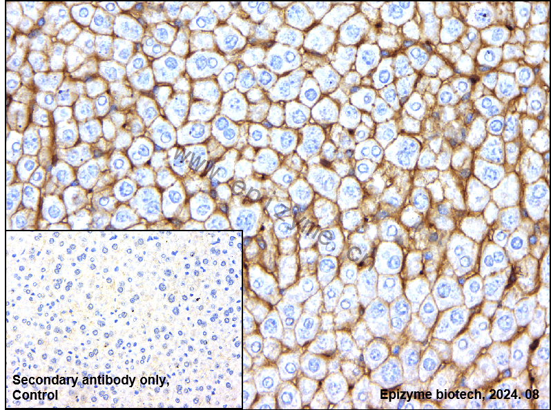 Anti-Phospho-PKC alpha (Thr497) Rabbit mAb [28S72F95]