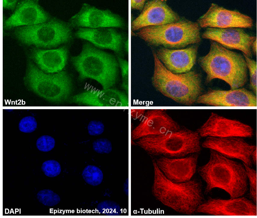 Anti-Wnt2b Rabbit mAb [45T51R63]