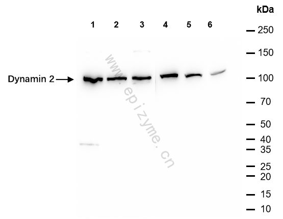 Anti-Dynamin 2 Rabbit mAb [17J03C35]