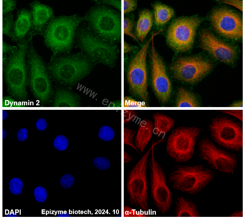 Anti-Dynamin 2 Rabbit mAb [17J03C35]