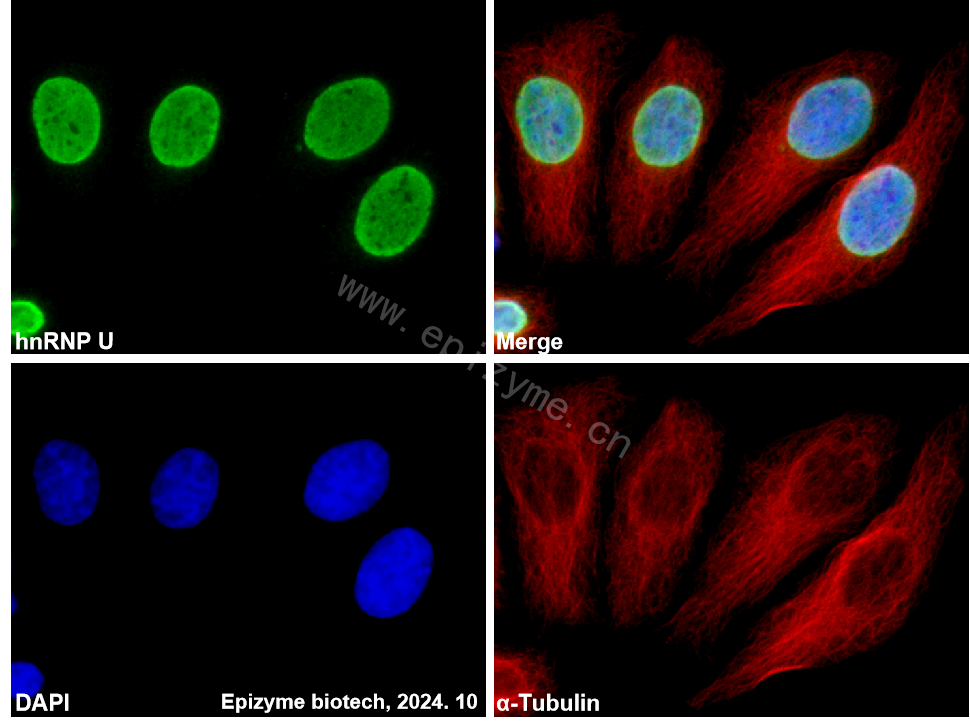 Anti-hnRNP U Rabbit mAb [49Q60G12]