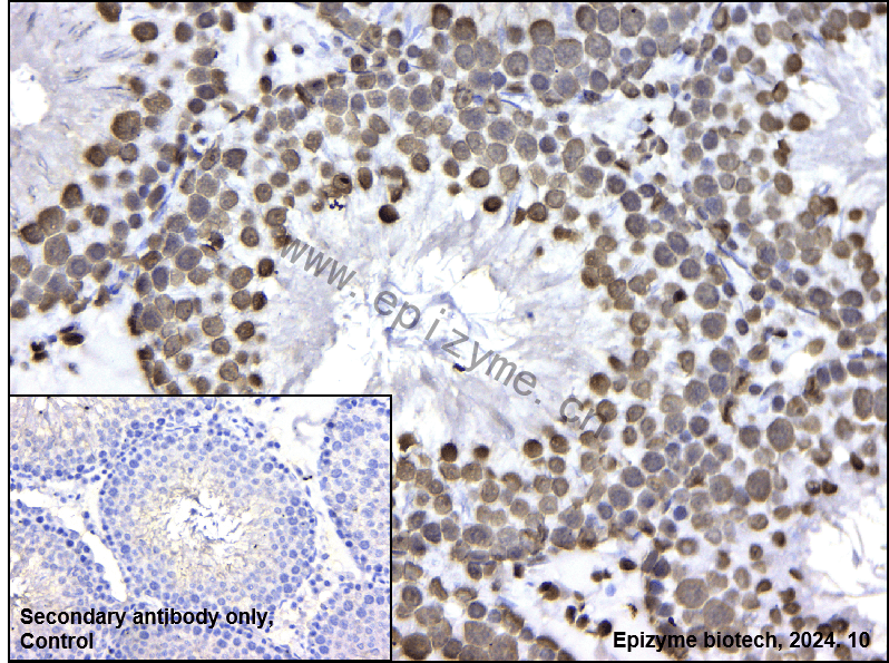 Anti-hnRNP U Rabbit mAb [49Q60G12]