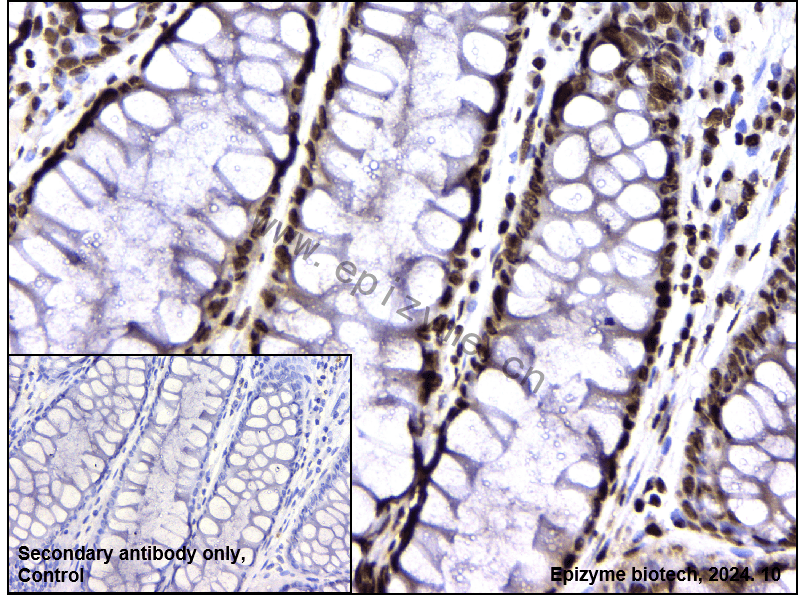 Anti-hnRNP U Rabbit mAb [49Q60G12]