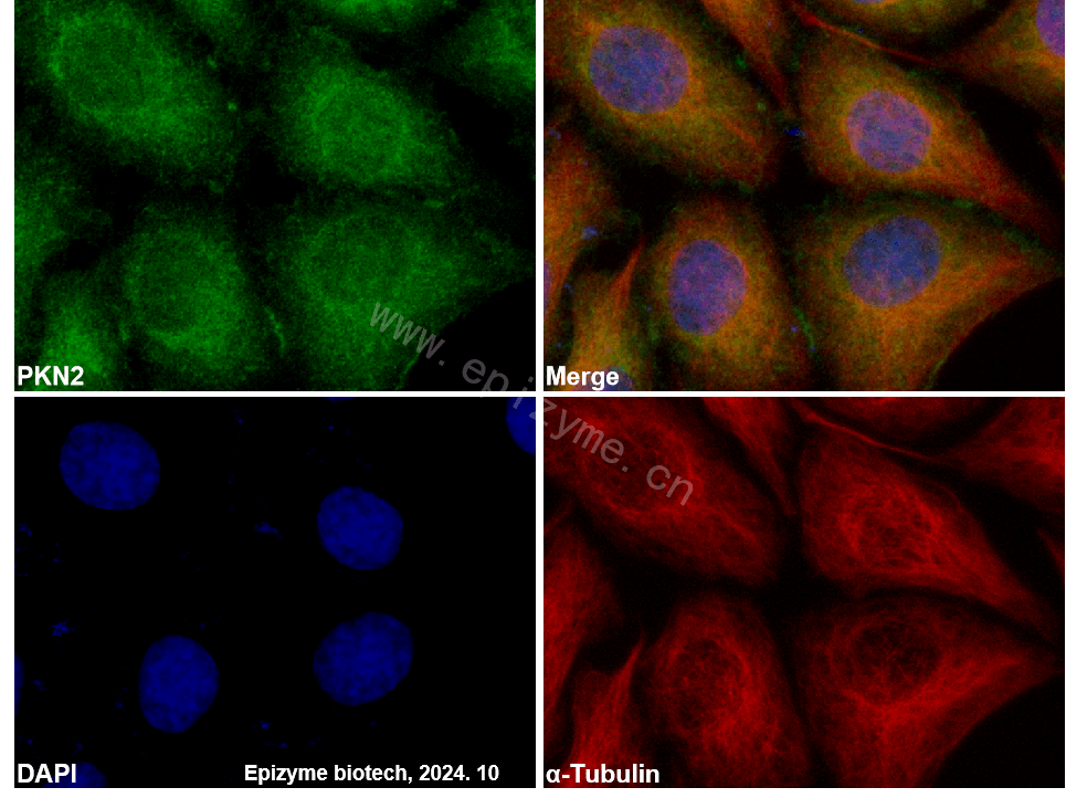 Anti-PKN2 Rabbit mAb [90N07Q69]